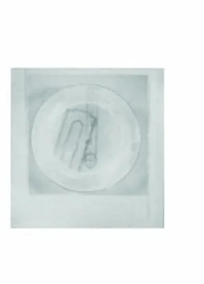 Myoma Instruments,Instruments For MicroTubal Operations